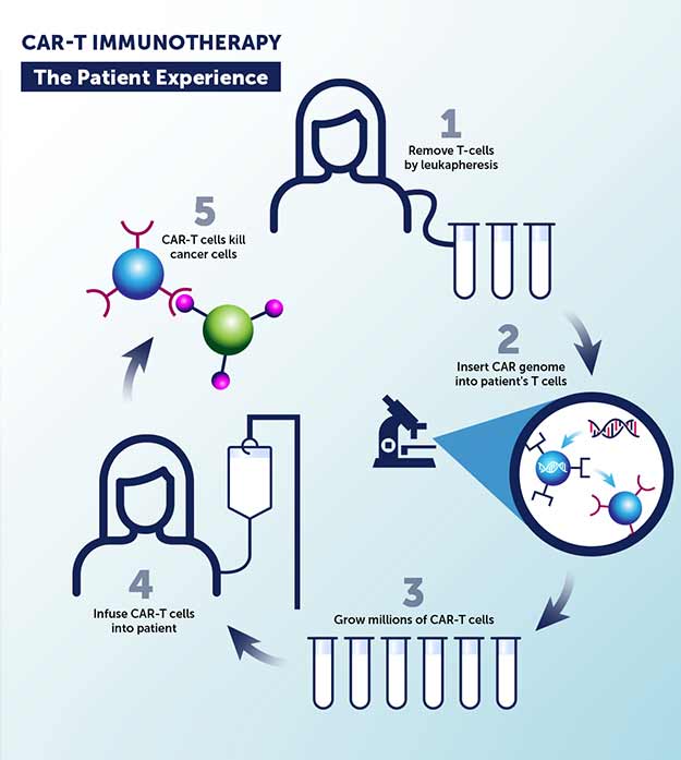 A graphic illustrates the five steps of the CAR-T patient experience: 1) Remove T-cells by leukapheresis; 2) insert CAR genome into patient’s T cells; 3) grow millions of CAR-T cells; 5) infuse CAR-T cells into patient; and 5) CAR-T cells kill cancer cells.