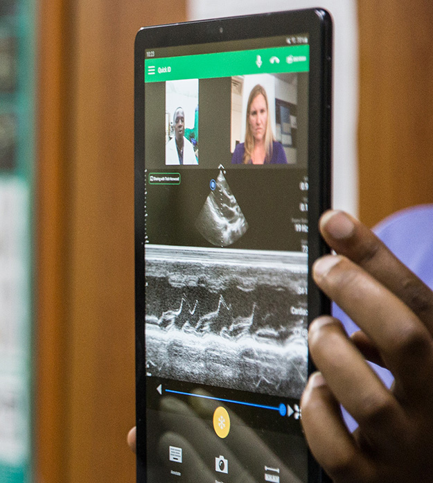 A doctor in a white lab coat and gloves stands in profile looking at a portable point-of-care ultrasound solution Philips Lumify with Reacts.